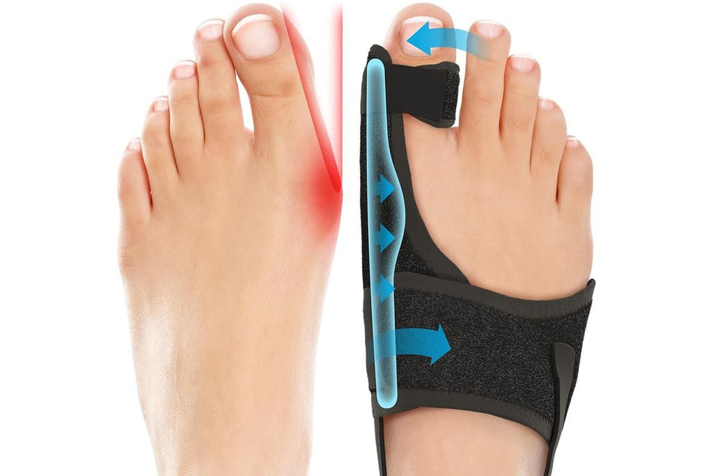 Ergonomic Bunion Corrector & Toe Straightener (1 Pair)