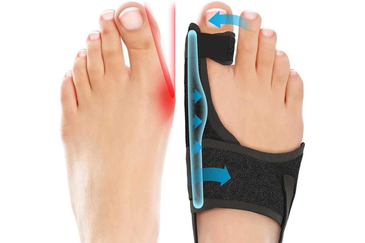 Ergonomic Bunion Corrector & Toe Straightener (1 Pair)